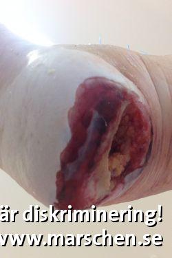 Bild på diskrimineringen.