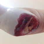 bild på Permobil, 2018-04-04