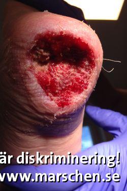 Bild 2 på diskrimineringen.