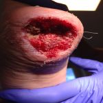 bild på Permobil, 2018-04-04